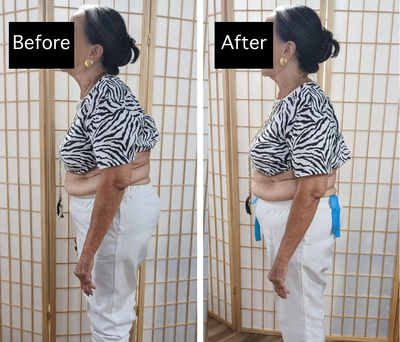 before and after women's posture image